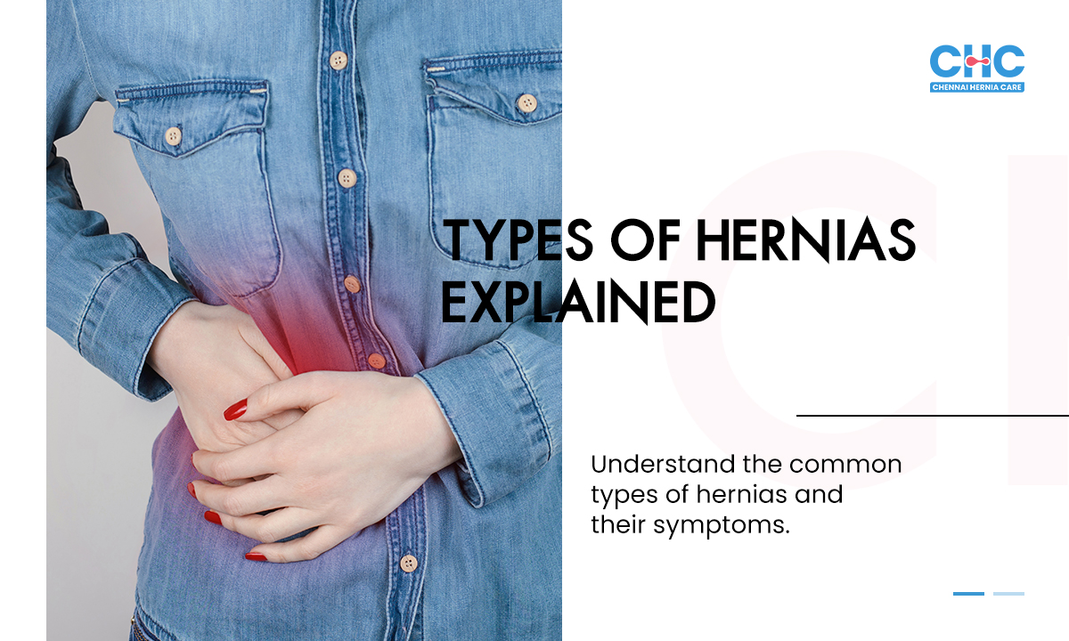 9 types of hernia explained