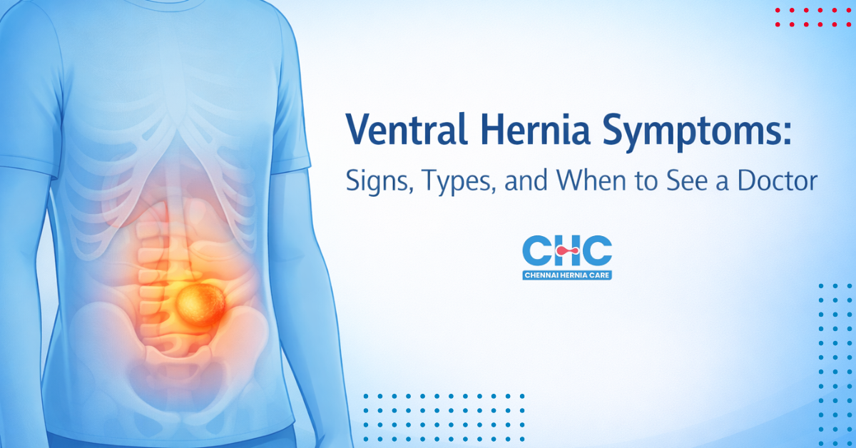 Medical graphic showing ventral hernia in the abdominal area of a human torso/