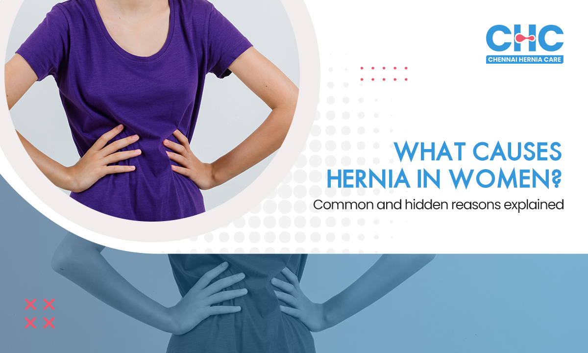 Illustration of what causes a hernia in women, highlighting abdominal and groin pressure points
