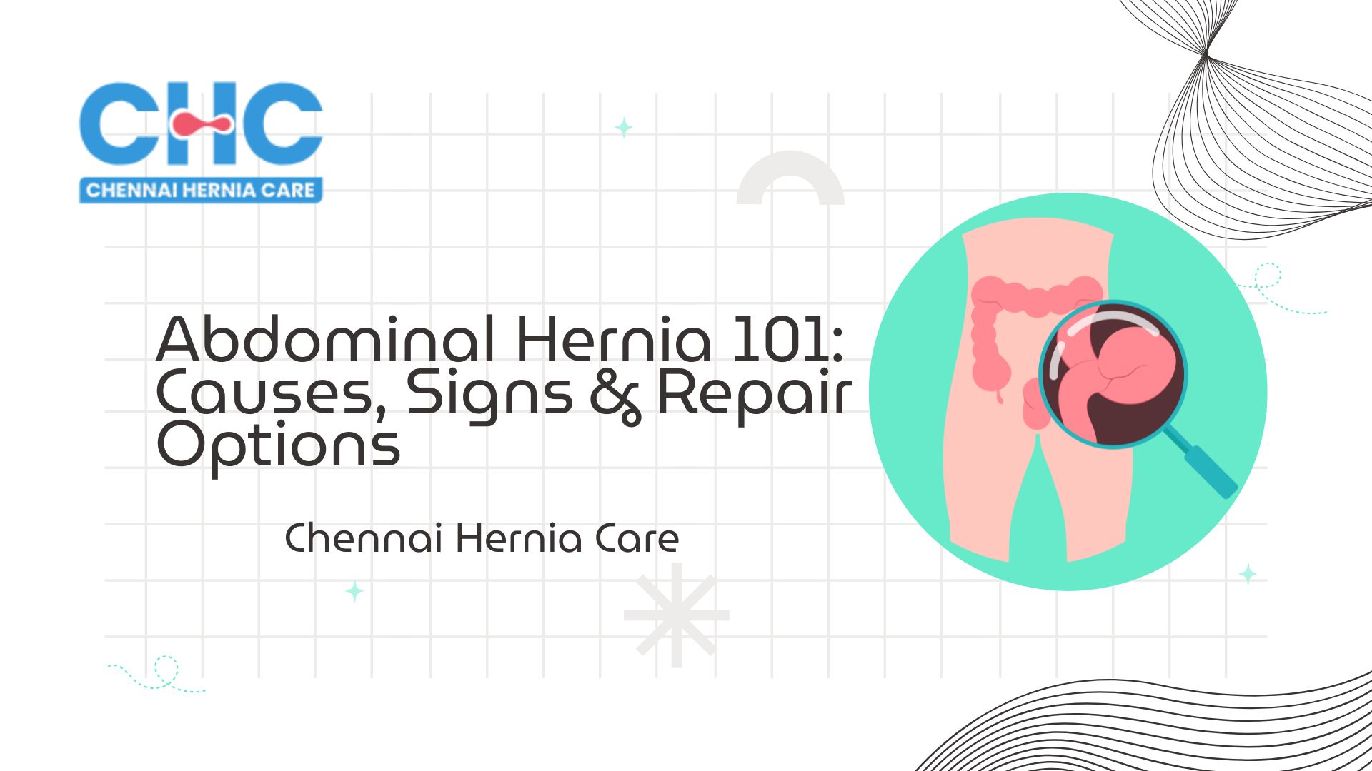 Abdominal Hernia