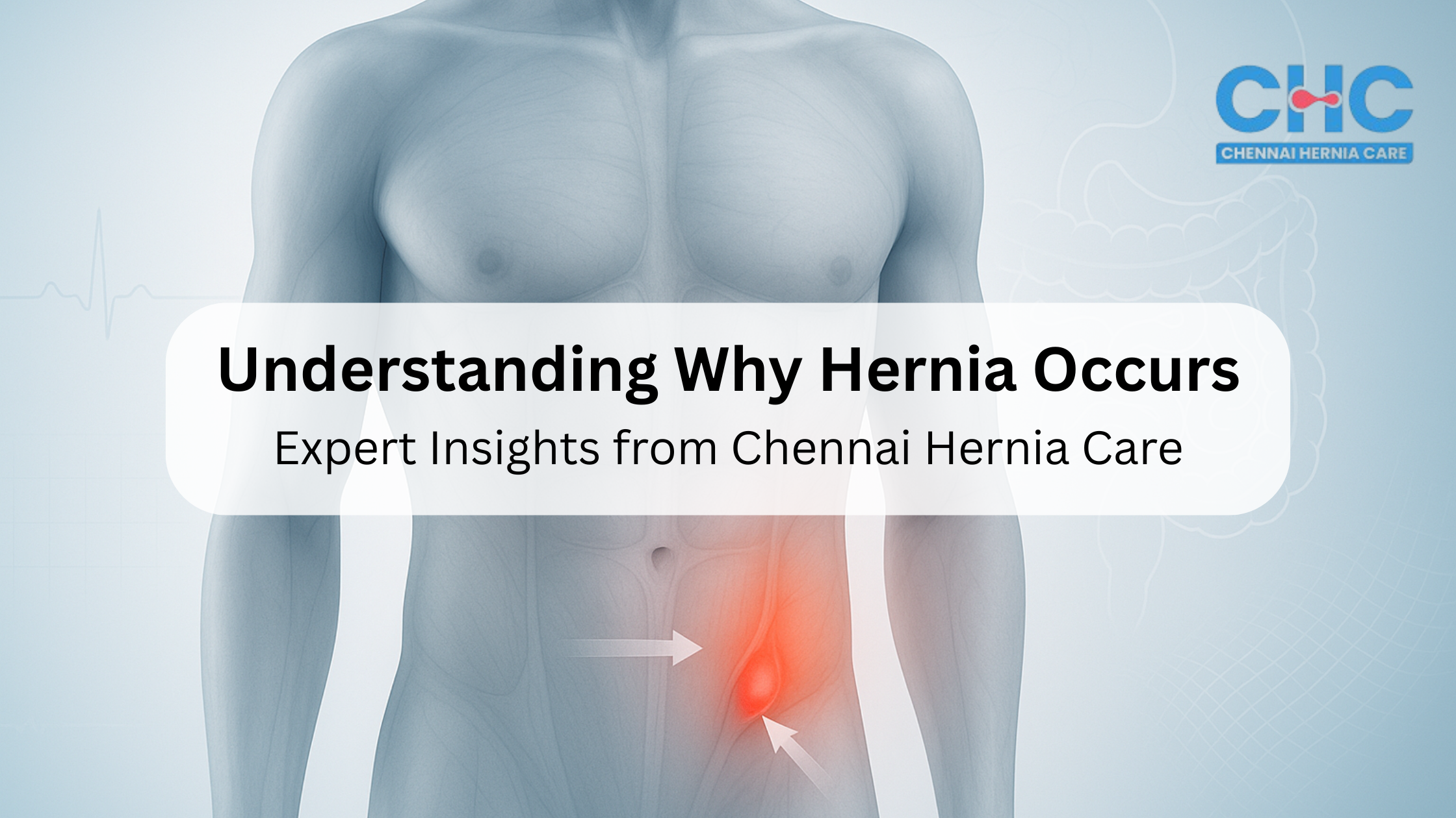 Hernia bulge near the navel with soft clinical overlays