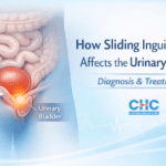Diagram of a sliding inguinal hernia affecting the urinary bladder, highlighting the inguinal canal and herniated bladder.