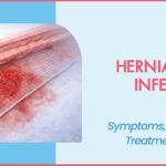 hernia-mesh